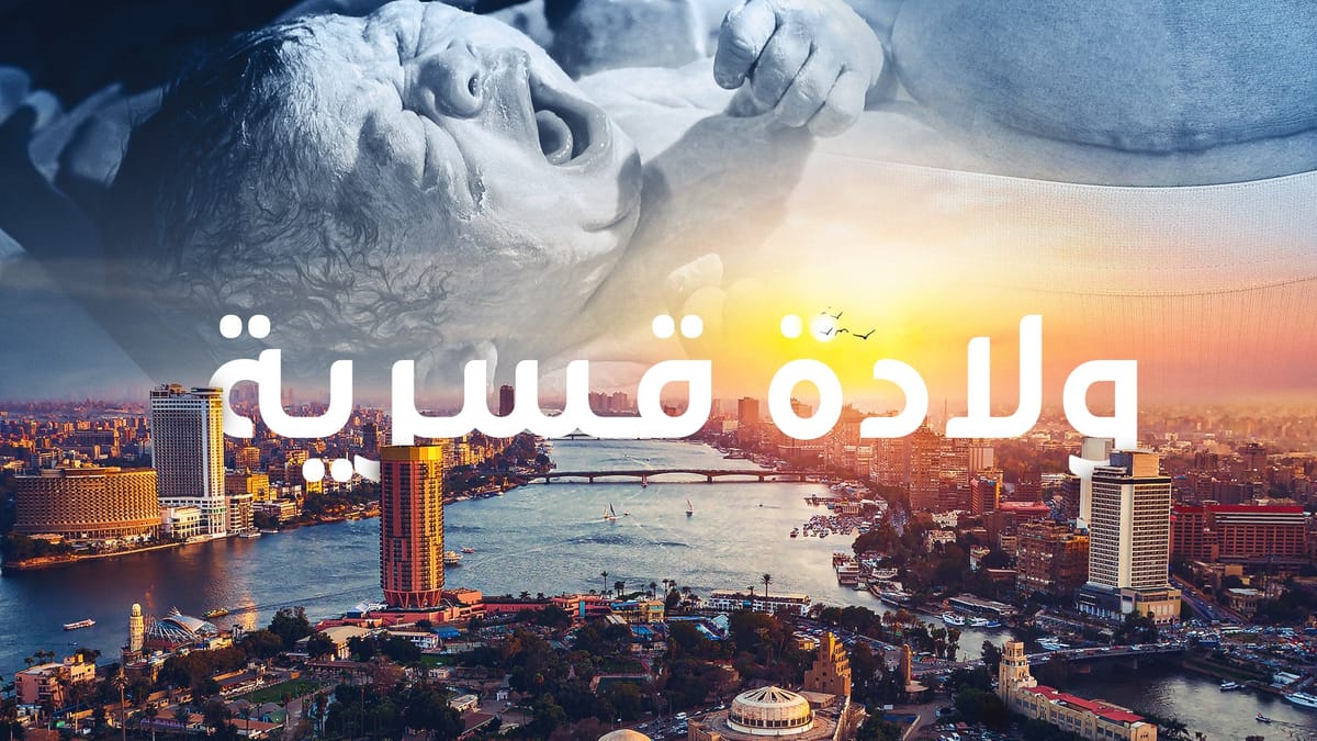 ولادة قسرية.