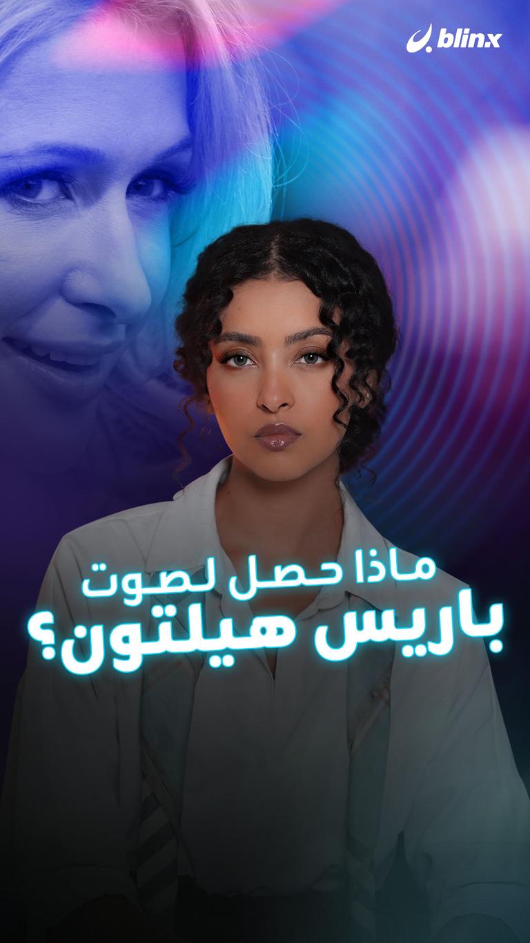 ماذا حصل لصوت باريس هيلتون؟
