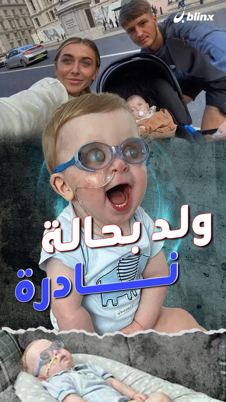 قصة طفل ولد ضريراً