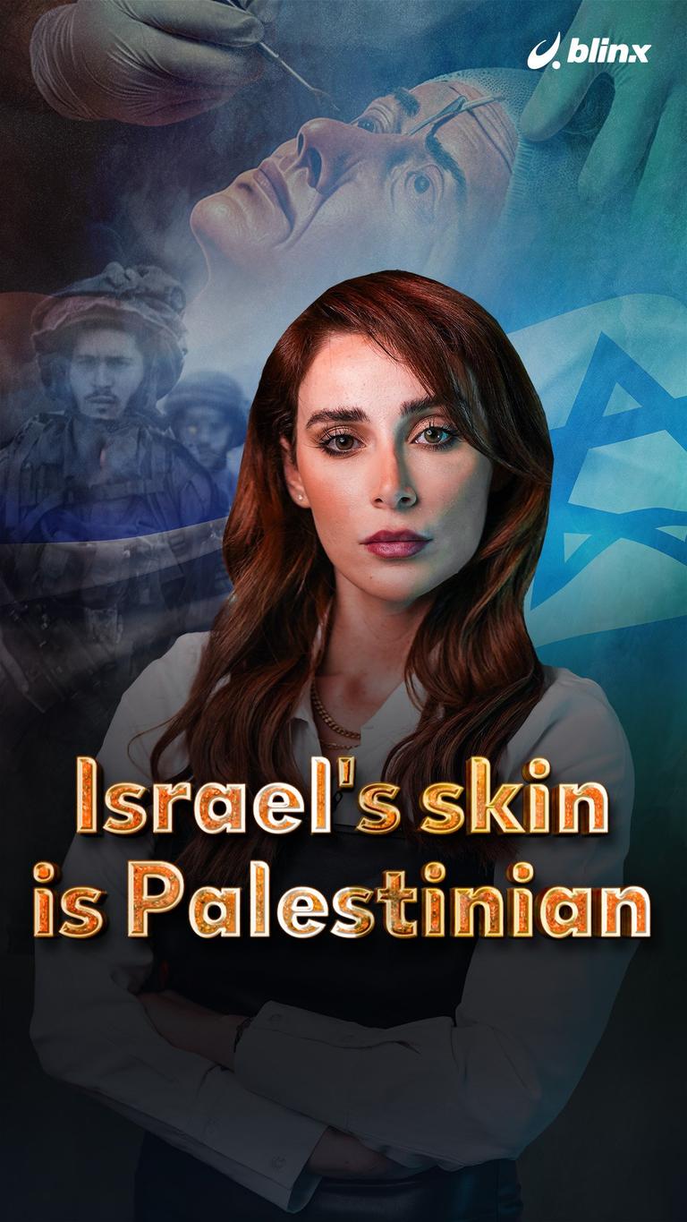 Israel's skin is Palestinian