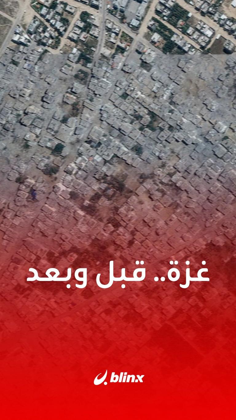 غزة.. قبل وبعد