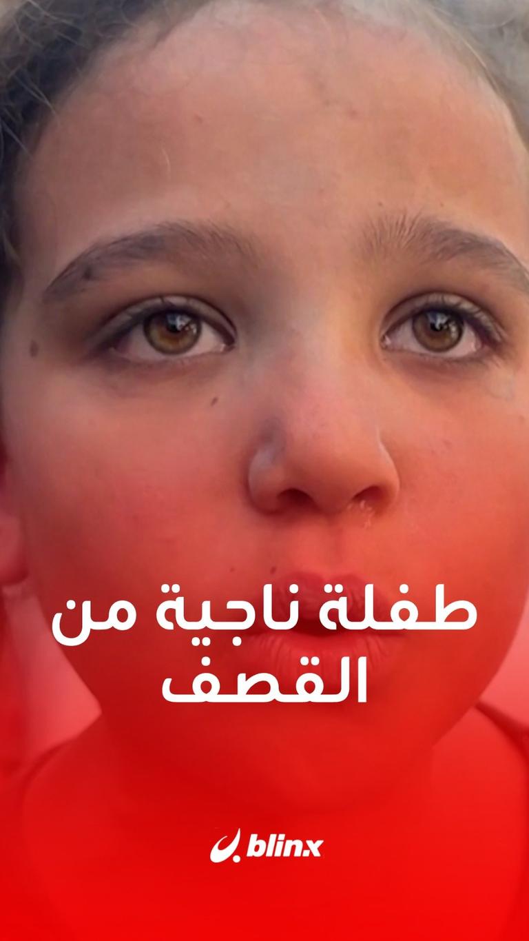 طفلة ناجية من القصف