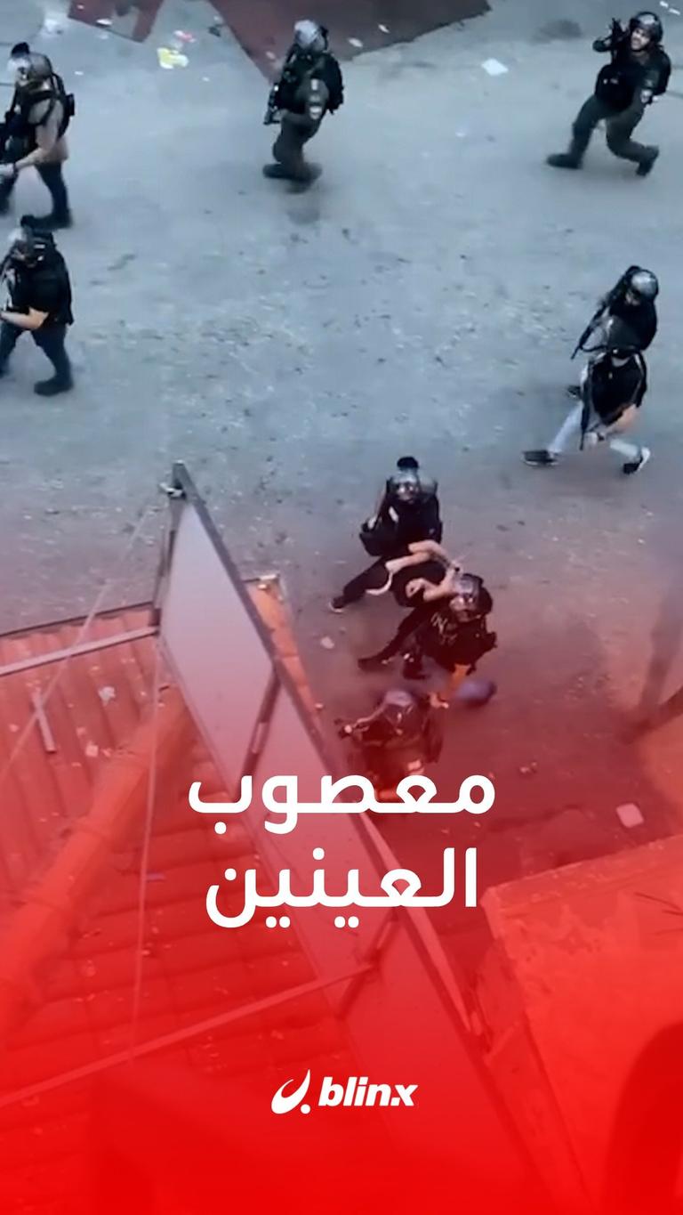 معصوب العينين