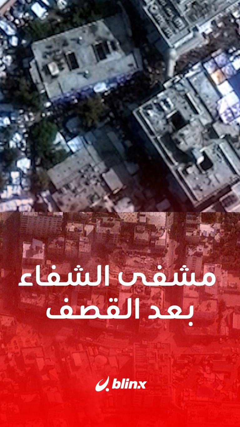 مشفى الشفاء بعد القصف