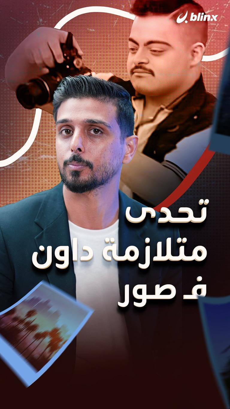 تحدى متلازمة داون بالتصوير