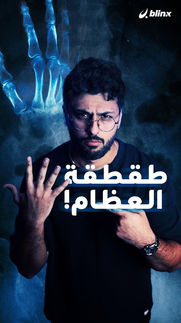 طقطقت العظام