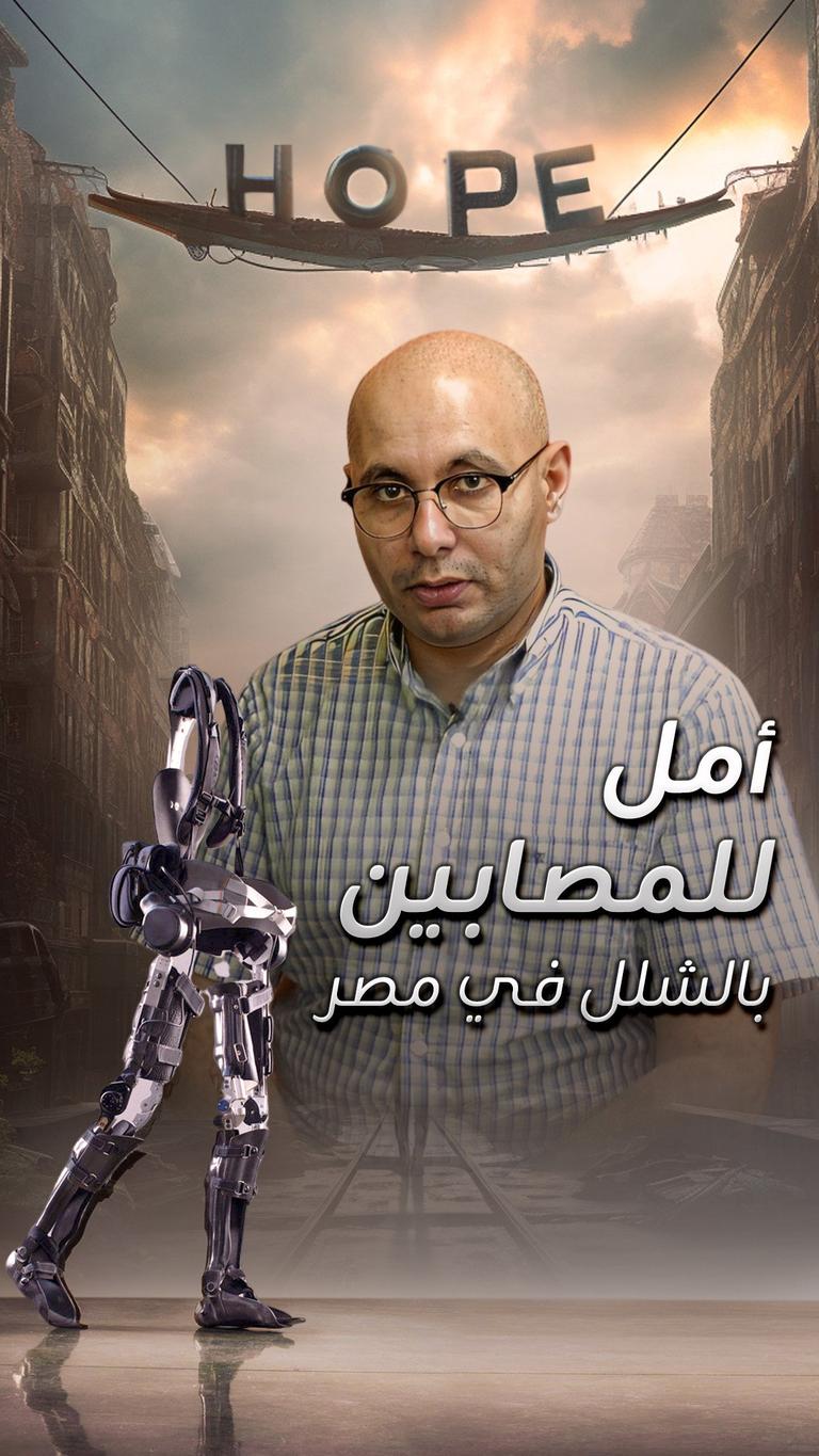 أمل للمصابين بالشلل في مصر