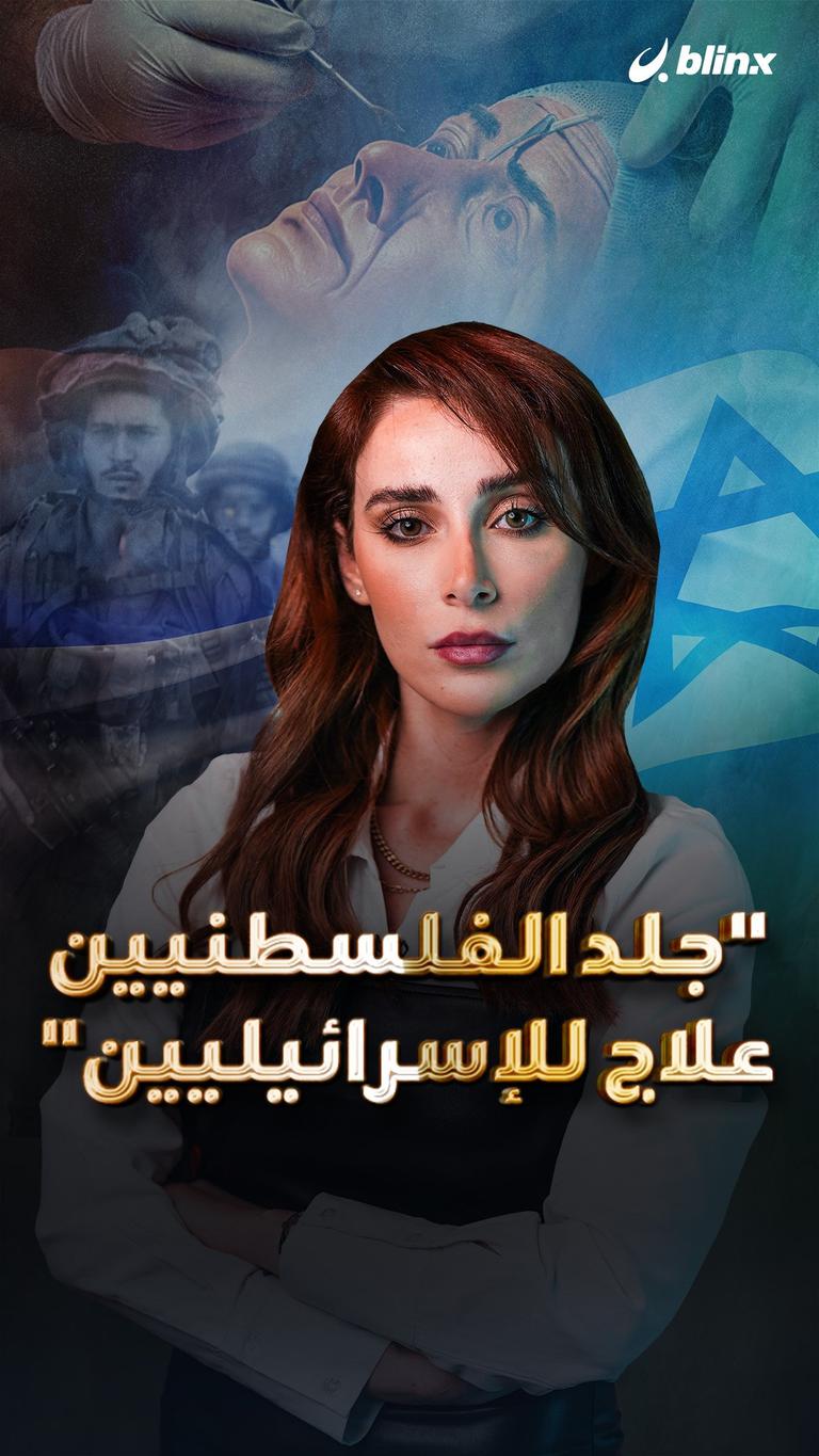 "جلد الفلسطنيين علاج للإسرائيليين"