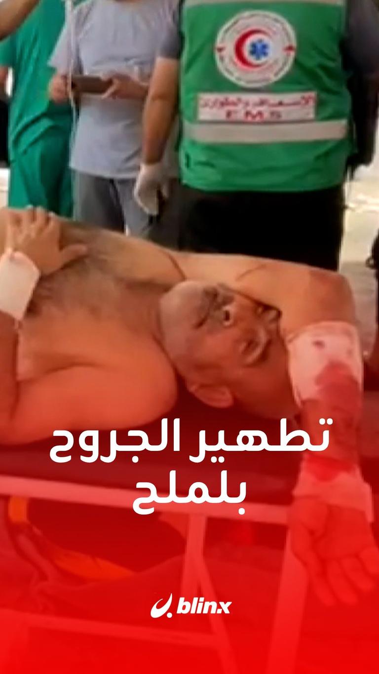 تطهير الجروح بلملح