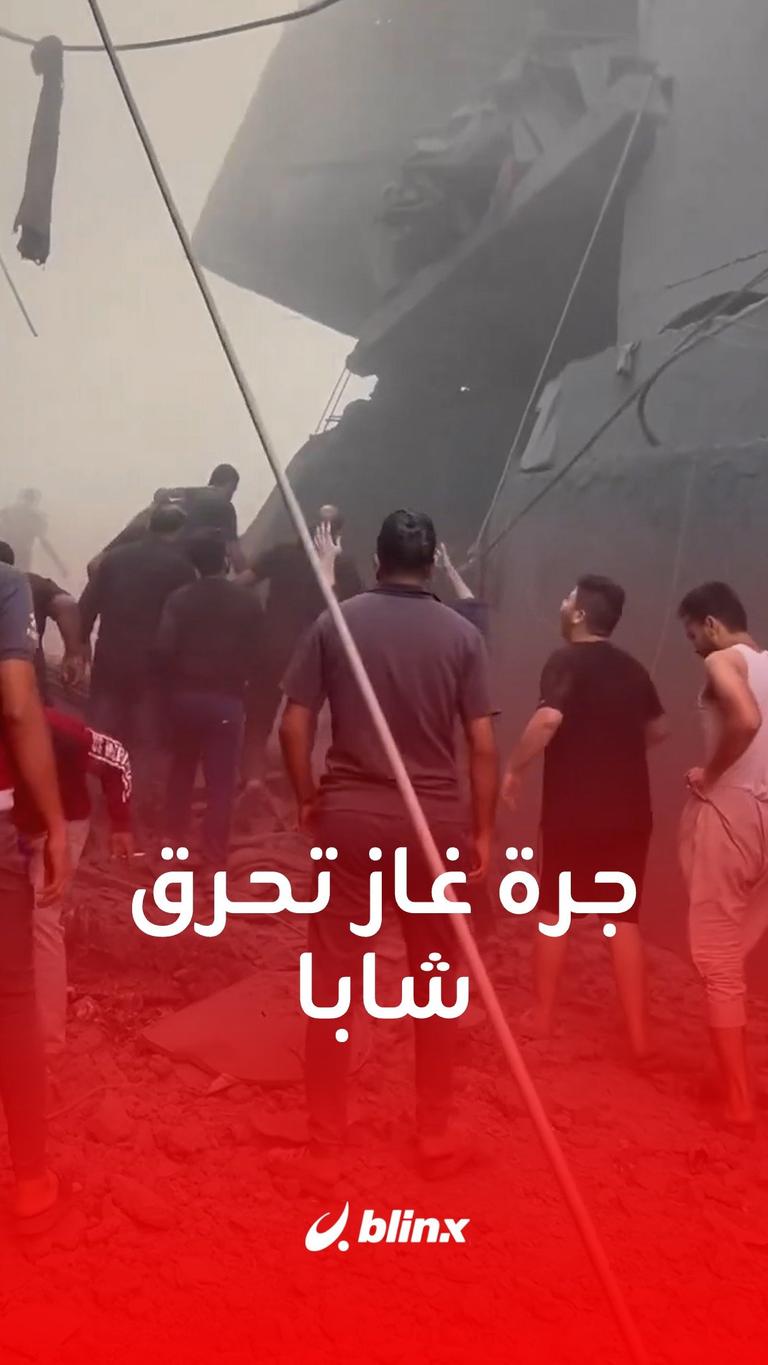 جرة غاز تحرق شابا كان يحاول إطفاءها بعد قصف إسرائيلي على #غزة