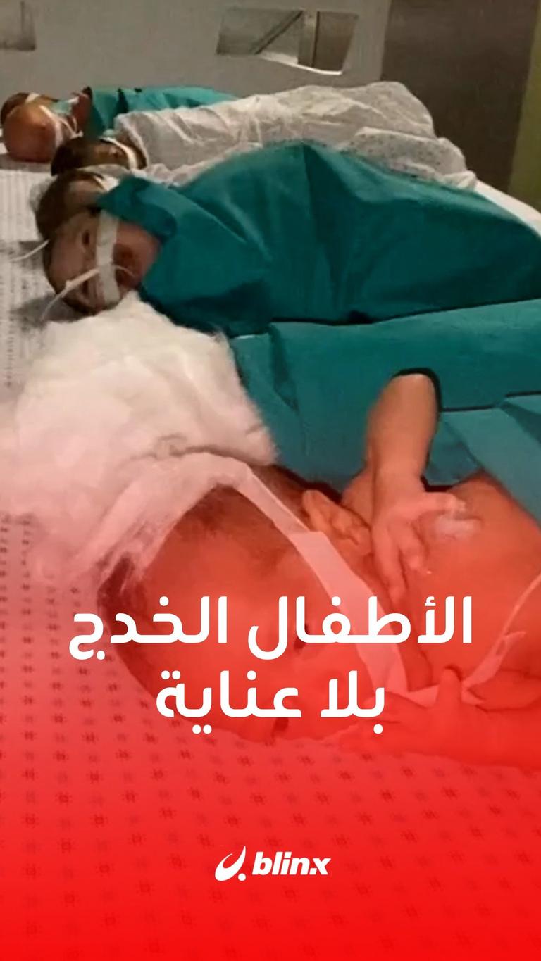 الأطفال الخدج بلا عناية