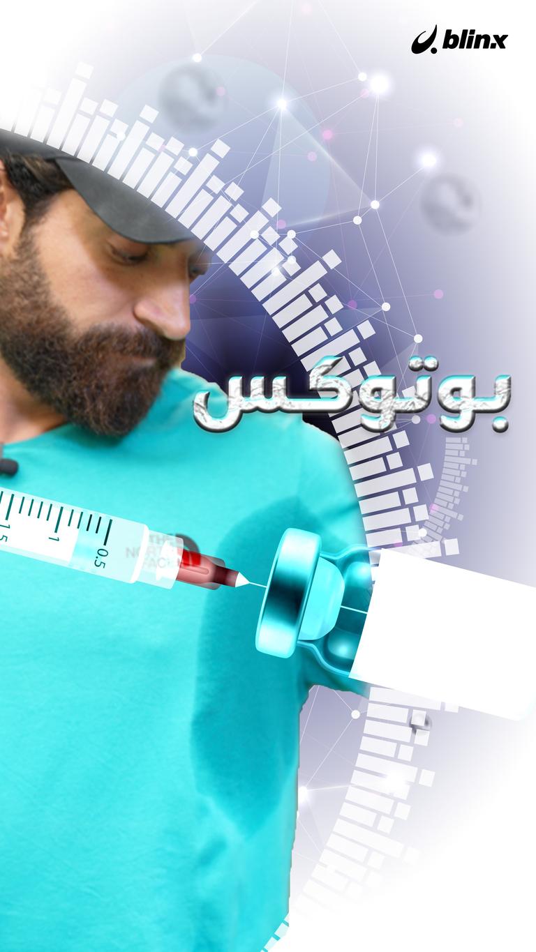 بوتوكس التعرق