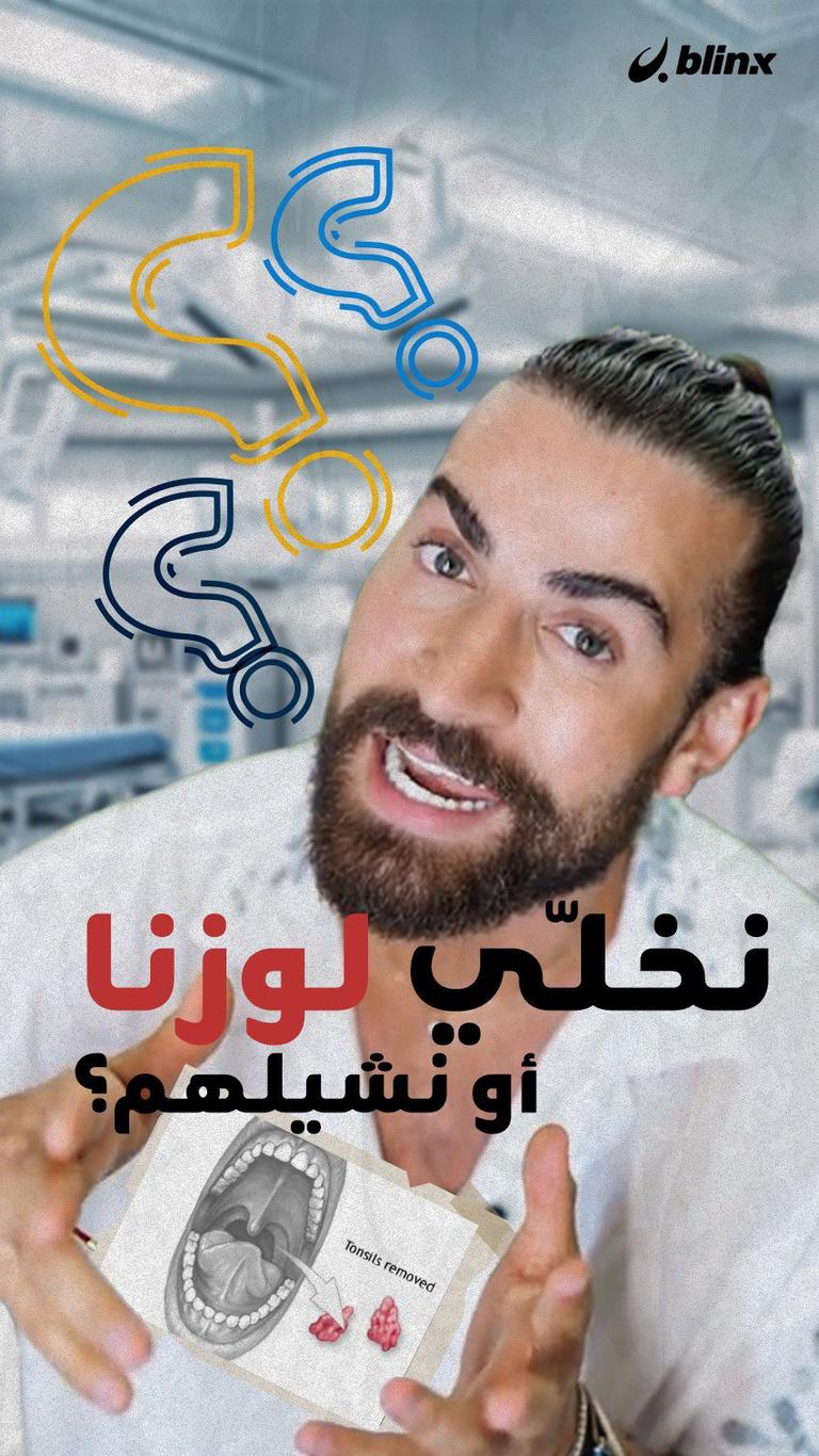 نخلّي لوزنا أو نشيلهم؟