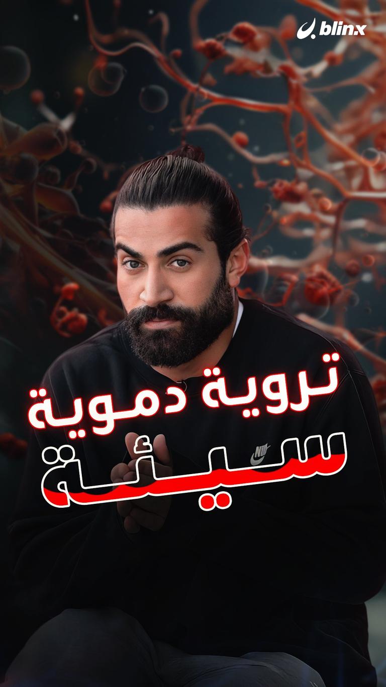 تروية دموية سيئة