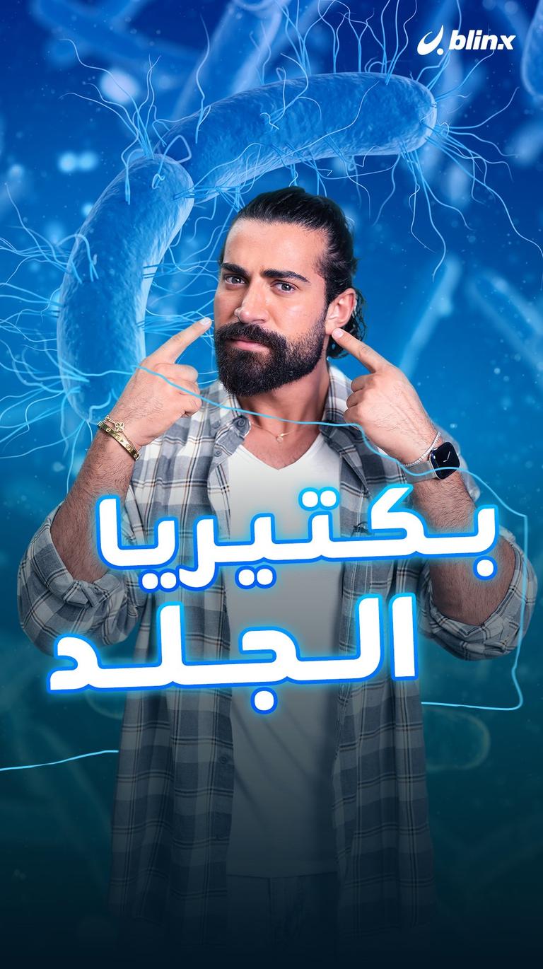 بكتيريا الجلد