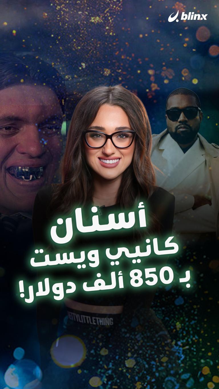 أسنان كانيي ويست بـ 850 ألف دولار!