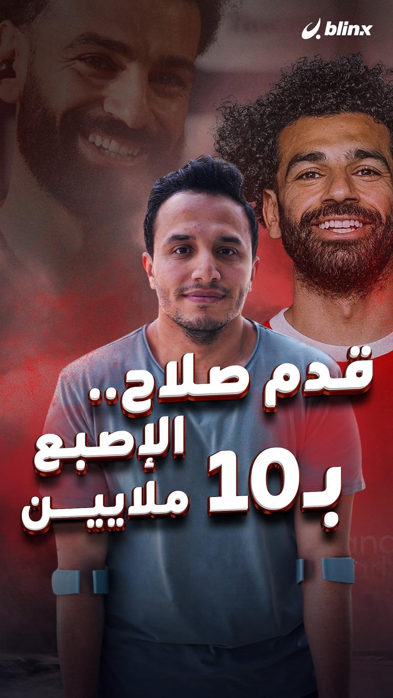 قدم صلاح.. الإصبع بـ10 ملايين