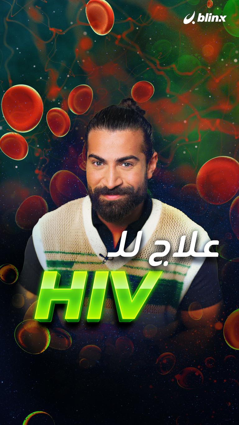 لقاح للـHIV