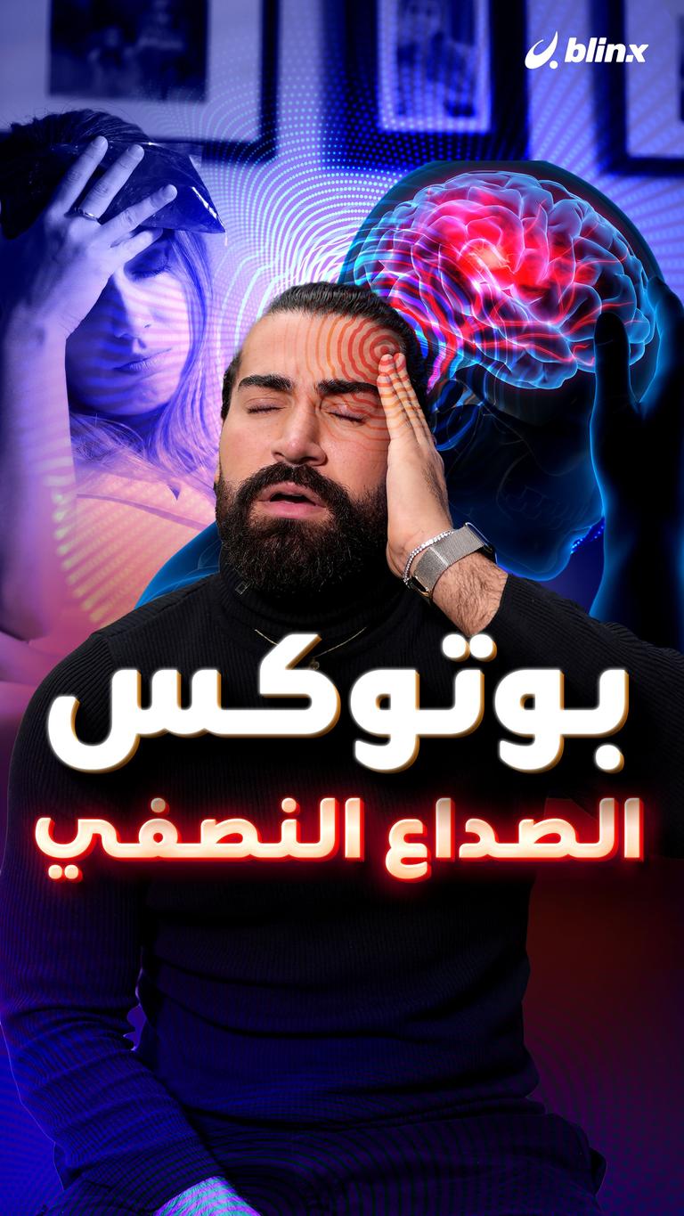 بوتوكس الصداع النصفي