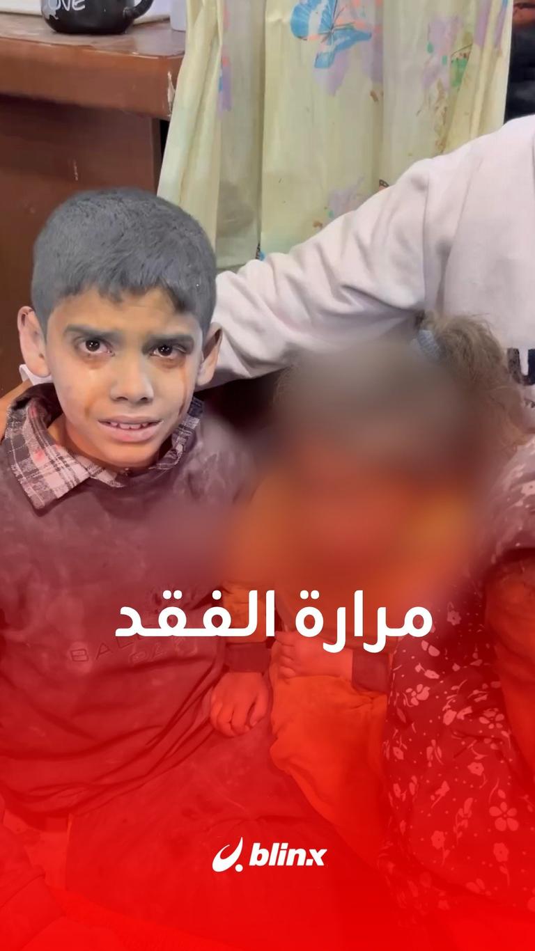 مرارة الفقد