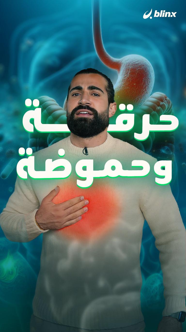 حرقة وحموضة