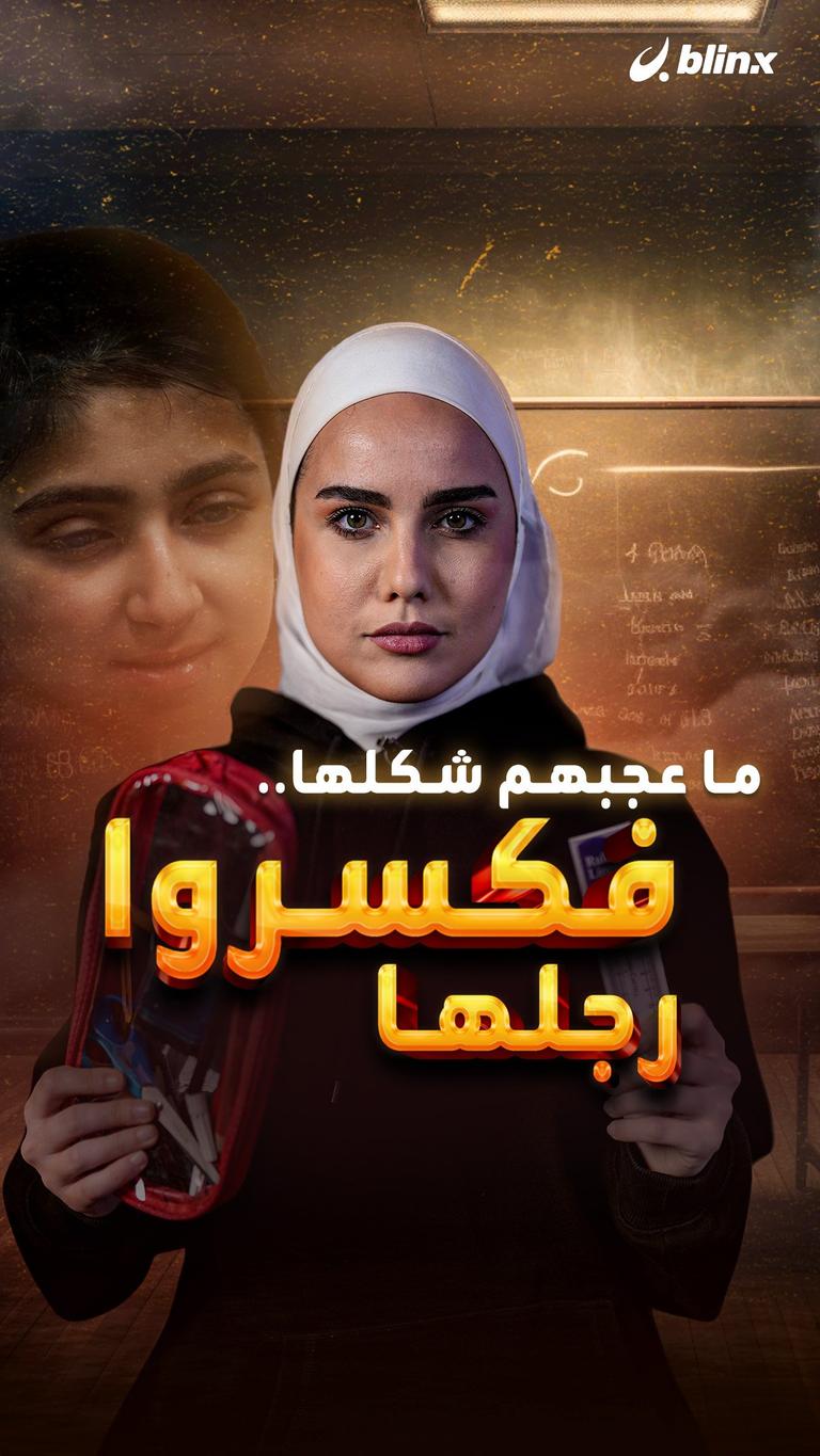 ما عجبهم شكلها.. فكسروا رجلها