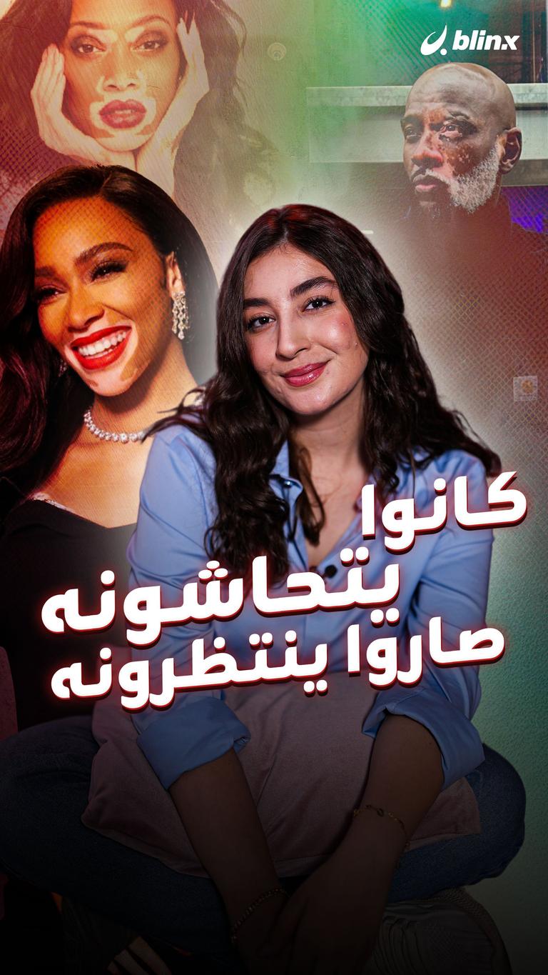 كانوا يتحاشونه صاروا ينتظرونه