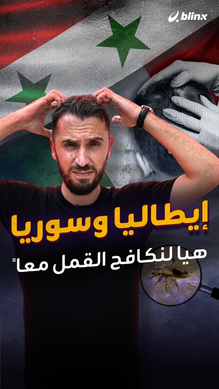 إيطاليا وسوريا.. "هيا لنكافح القمل معاً"