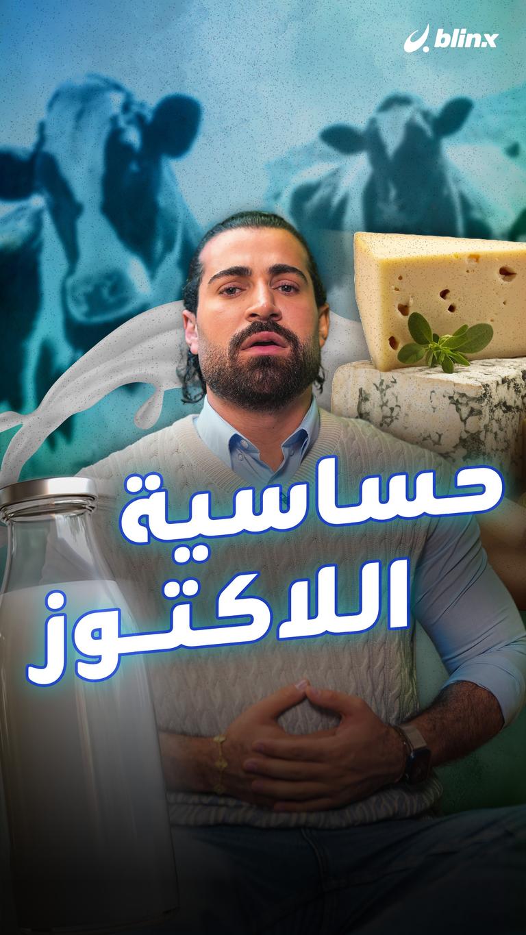 حساسية اللاكتوز