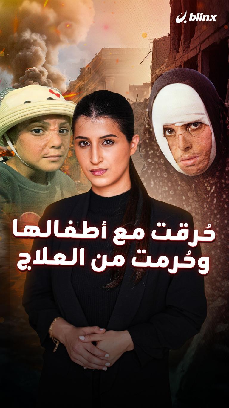 حُرقت مع أطفالها وحُرمت من العلاج