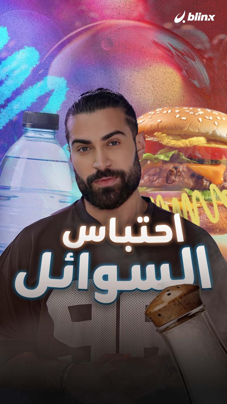 احتباس السوائل