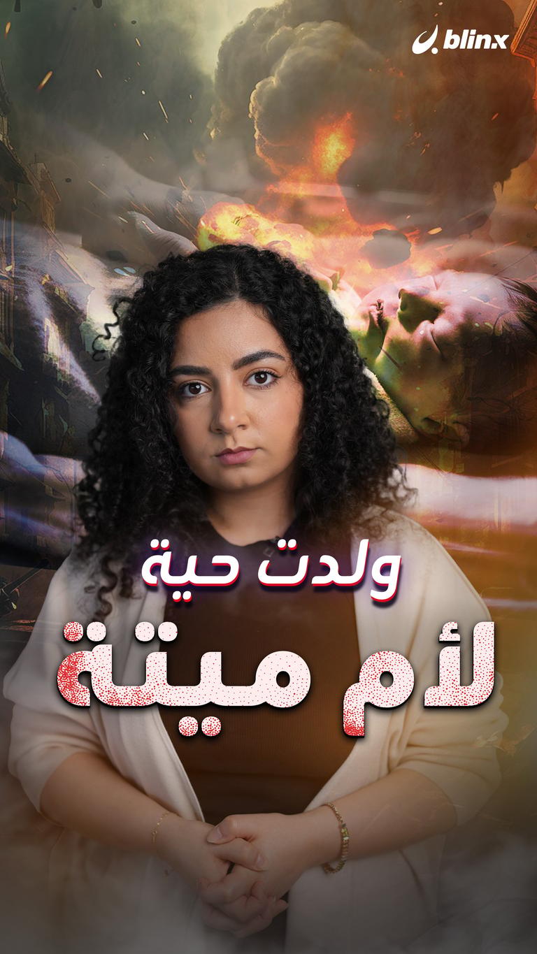 ولدت حية لأم ميتة