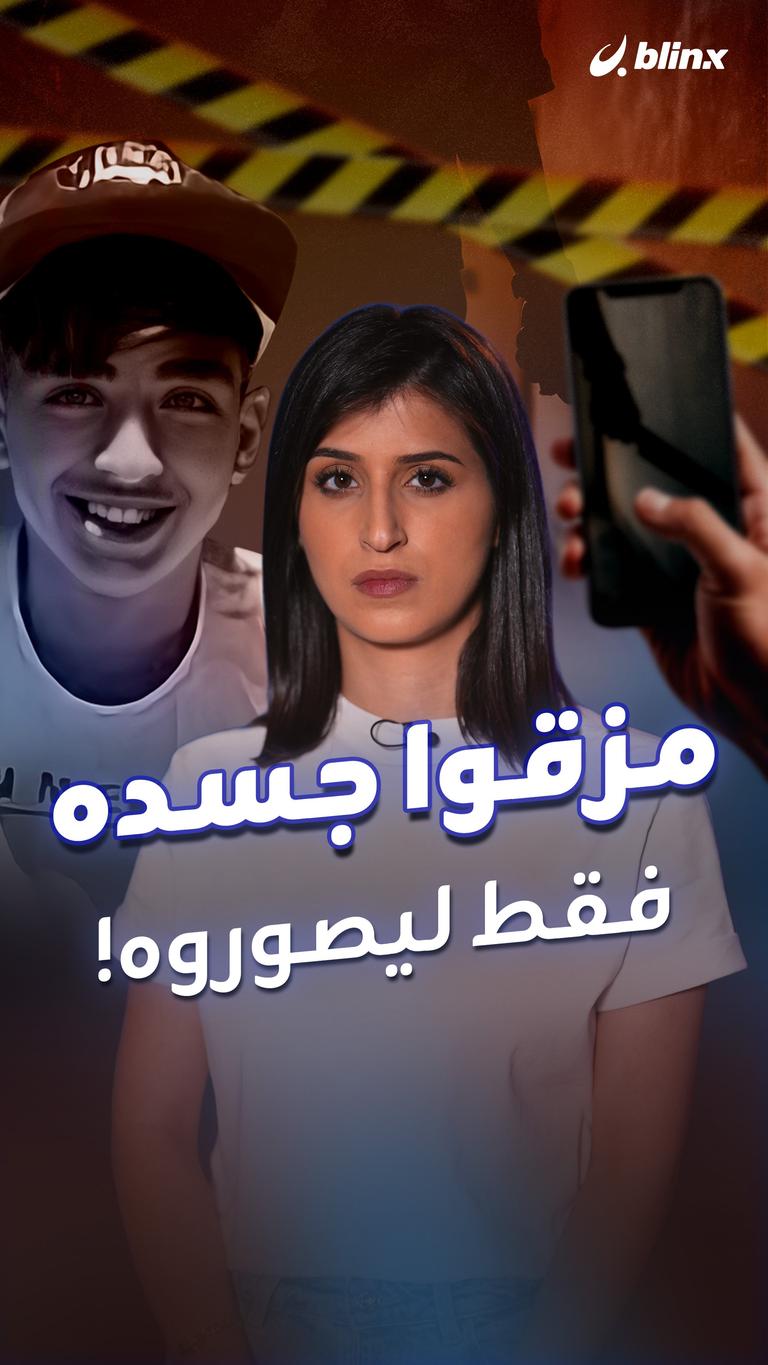 مزقوا جسده فقط ليصوروه!