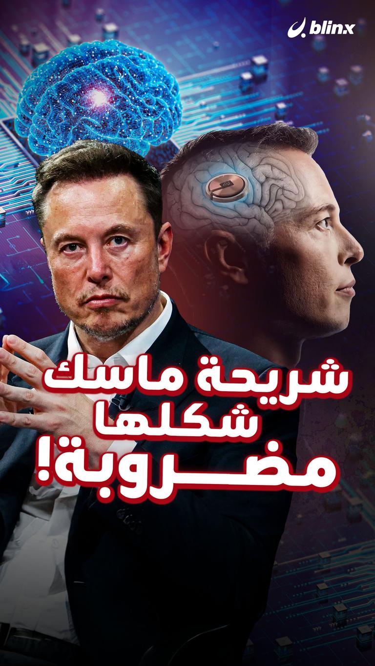 شريحة ماسك شكلها مضروبة!