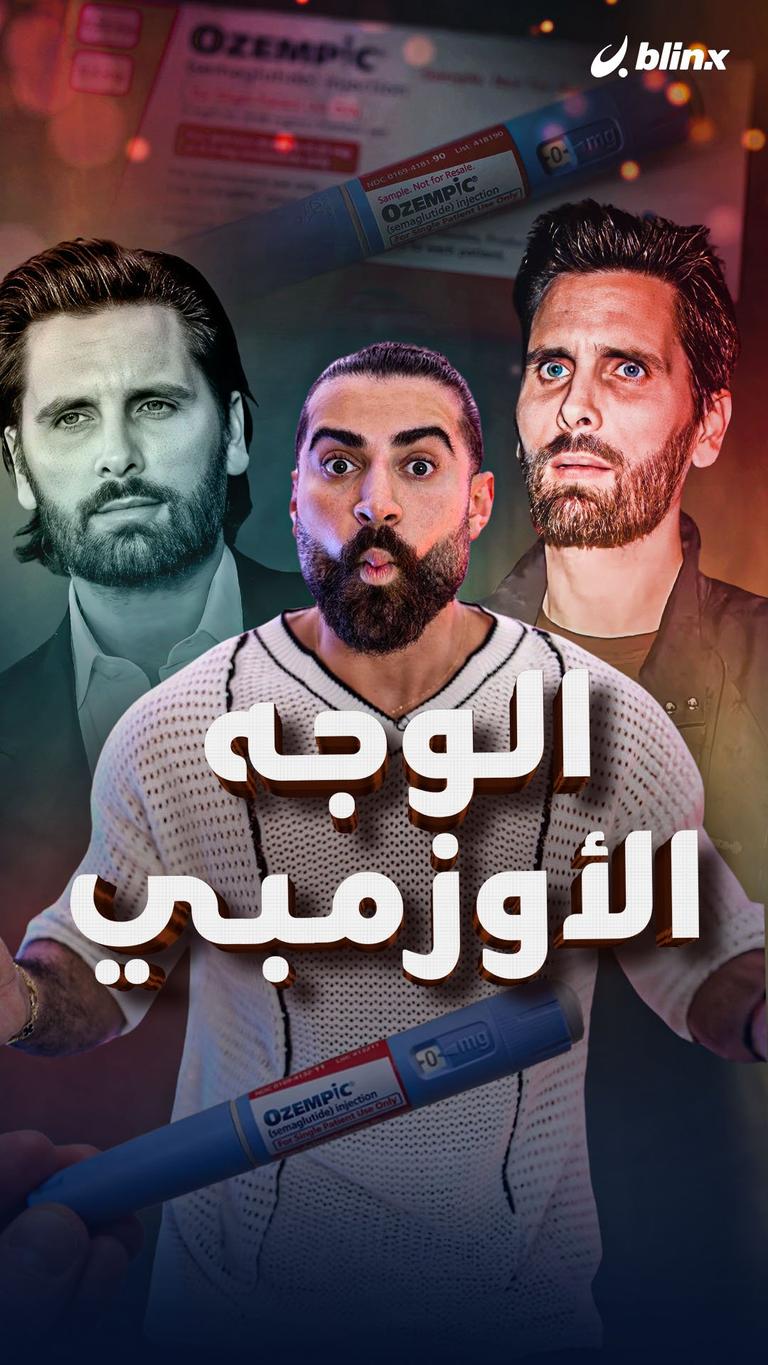 الوجه الأوزمبي