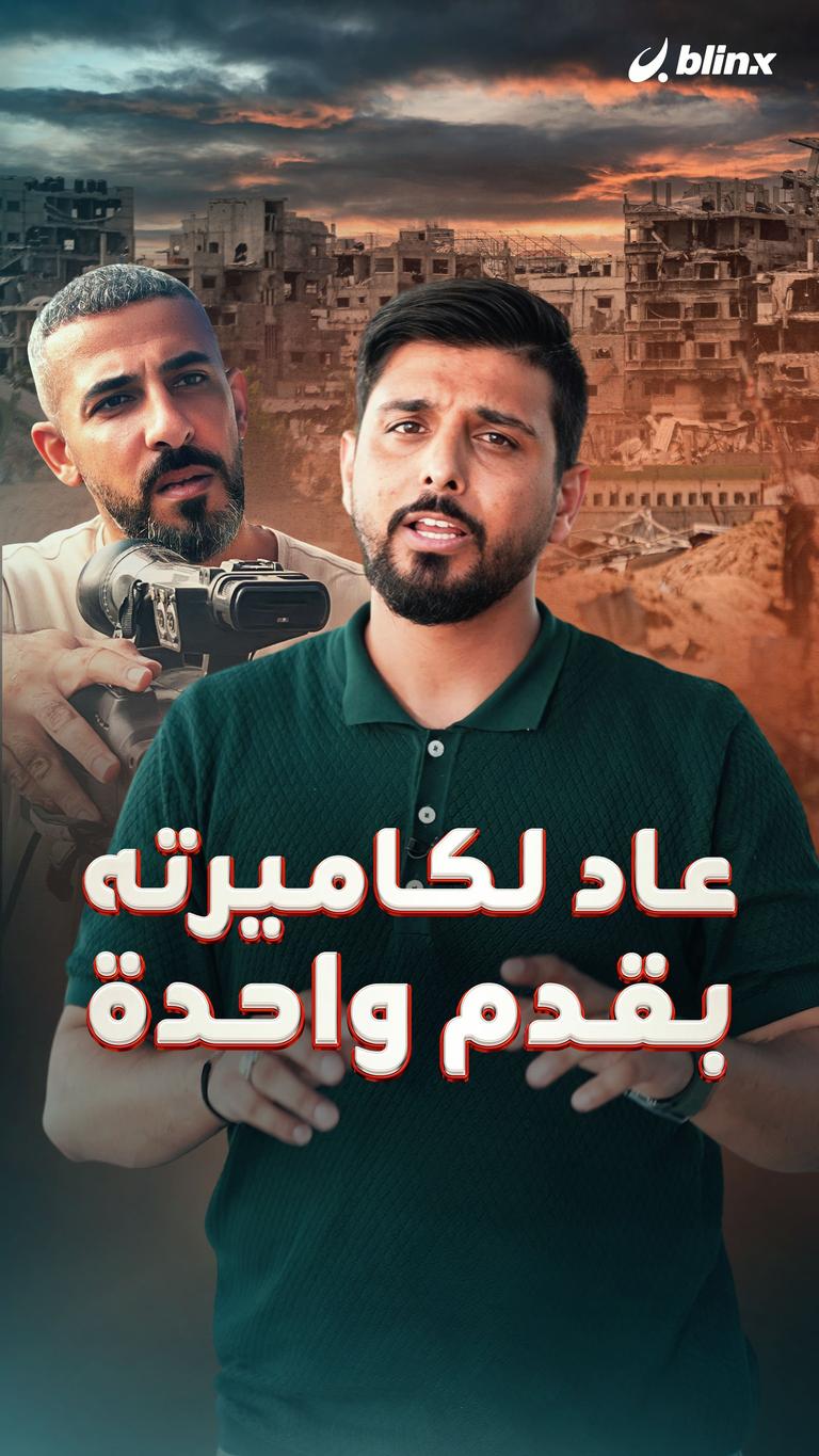 عاد لكاميرته بقدم واحدة