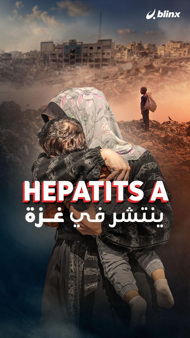Hepatits A ينتشر في غزة