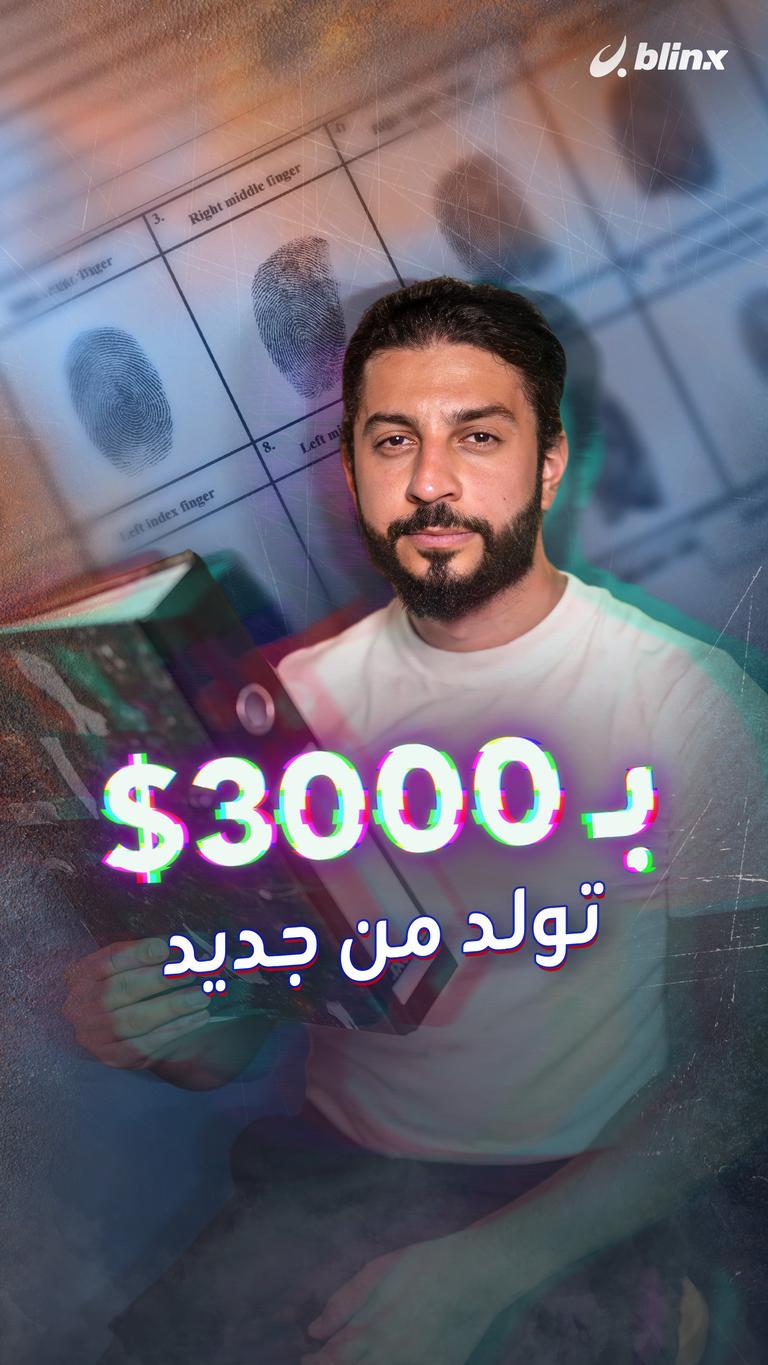 بـ 3000$ تولد من جديد