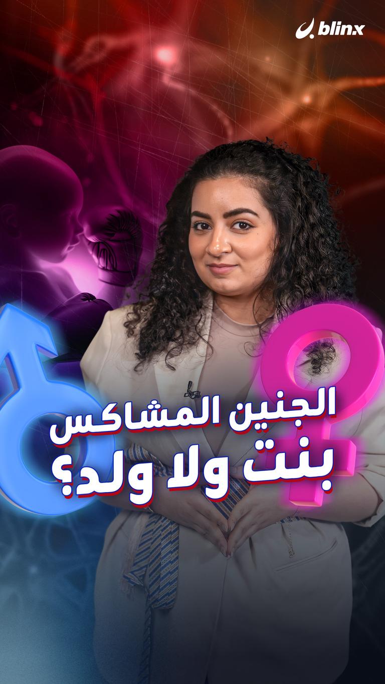 الجنين المشاكس... بنت ولا ولد؟