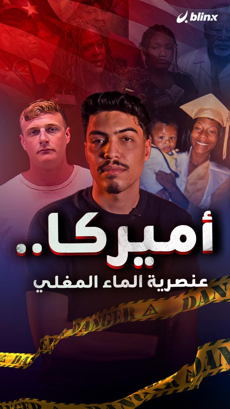 أميركا.. عنصرية الماء المغلي