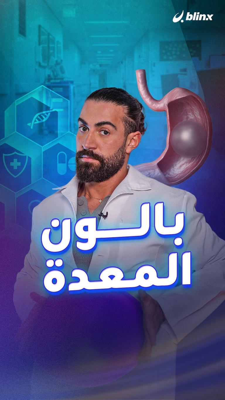 بالون المعدة