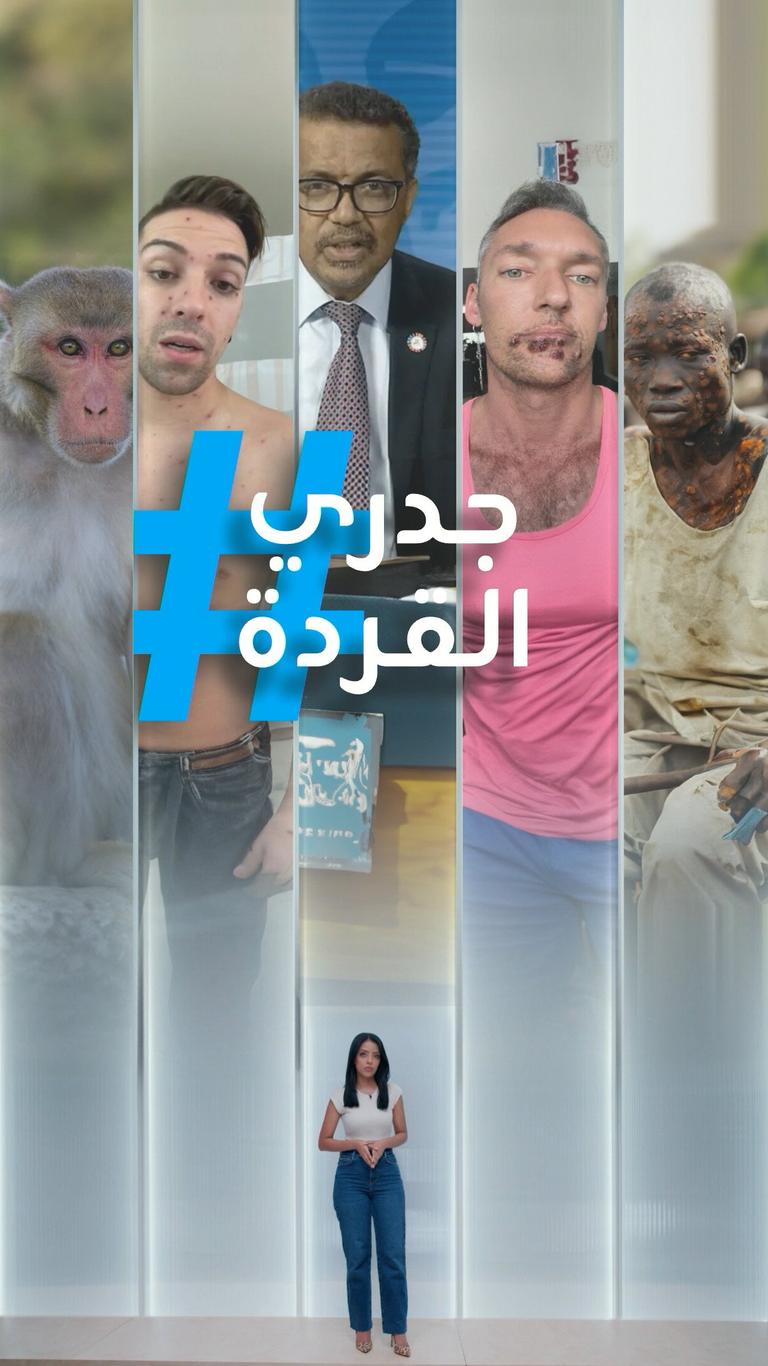 "مؤامرة شيطانية".. جدل جدري القردة!