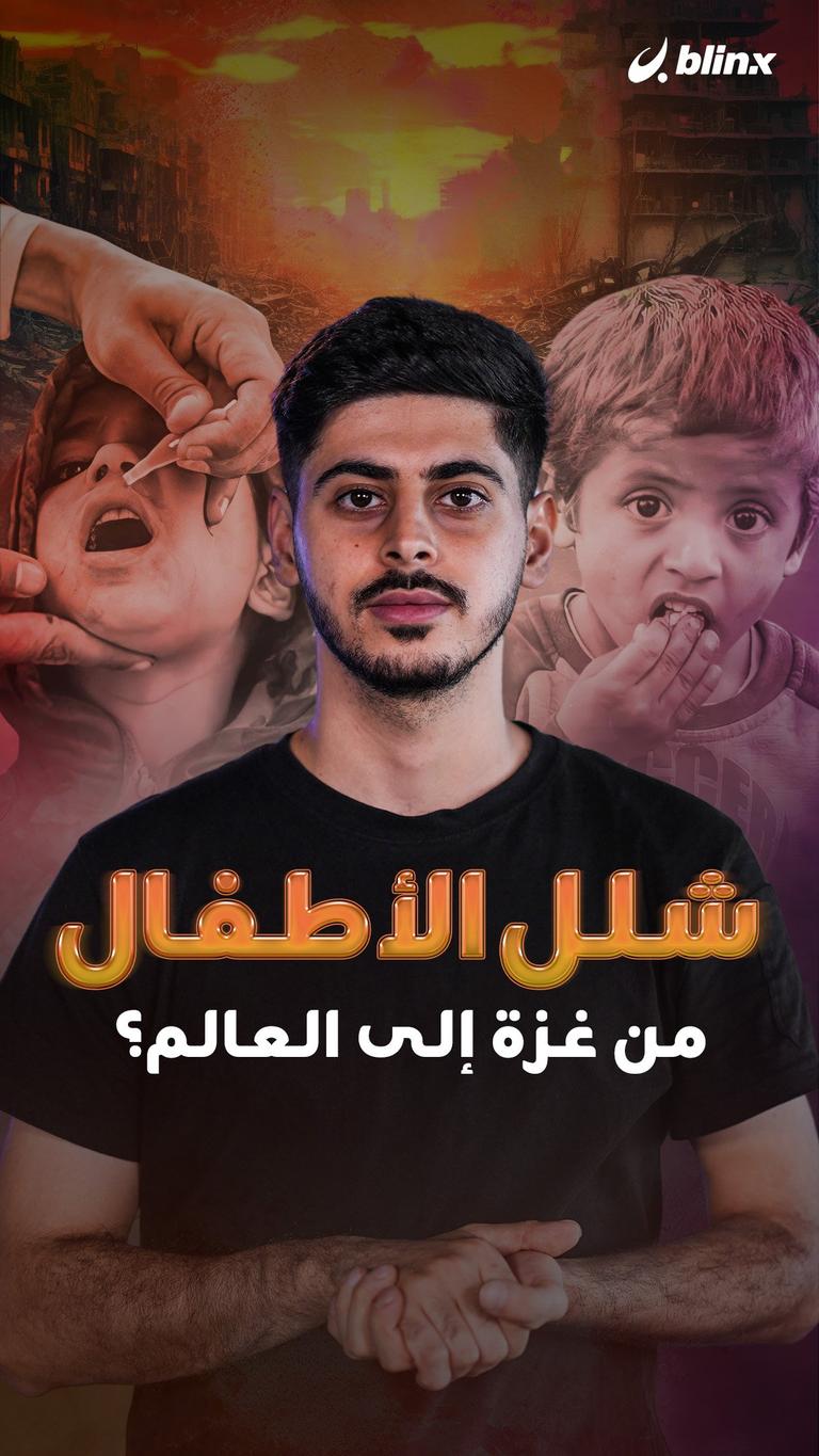 شلل الأطفال من غزة إلى العالم؟