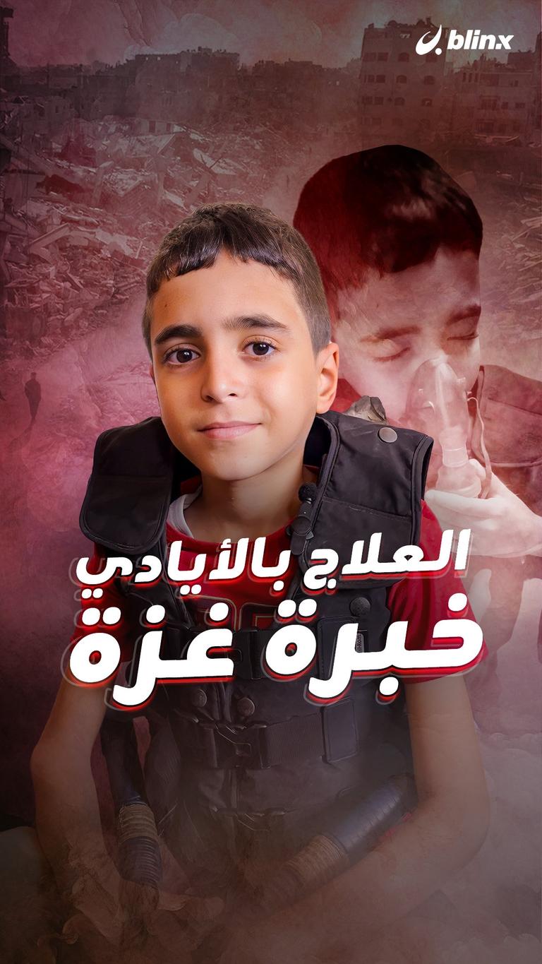 العلاج بالأيادي... خبرة غزة