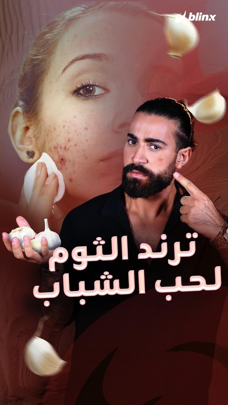 ترند الثوم لحب الشباب