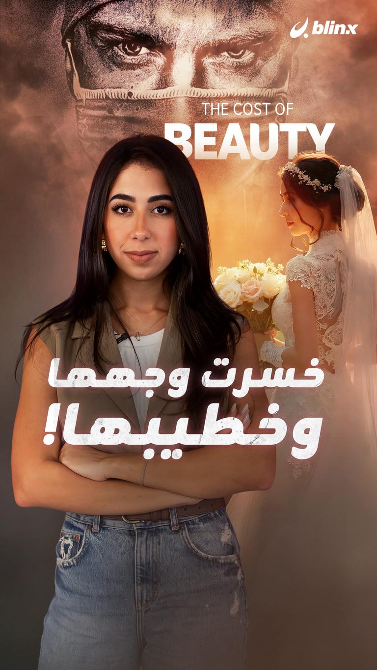 خسرت وجهها وخطيبها!