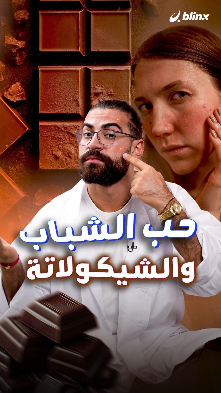 حب الشباب والشوكولا