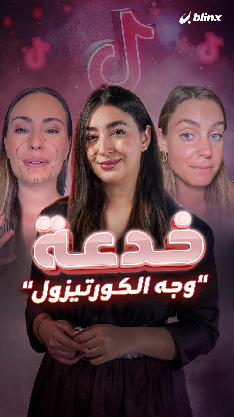 خدعة "وجه الكورتيزول"