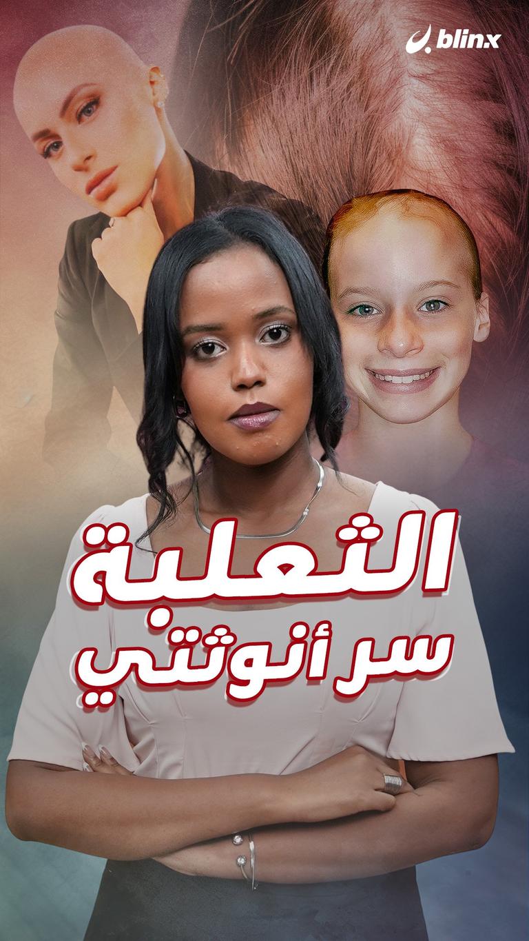 الثعلبة سر أنوثتي