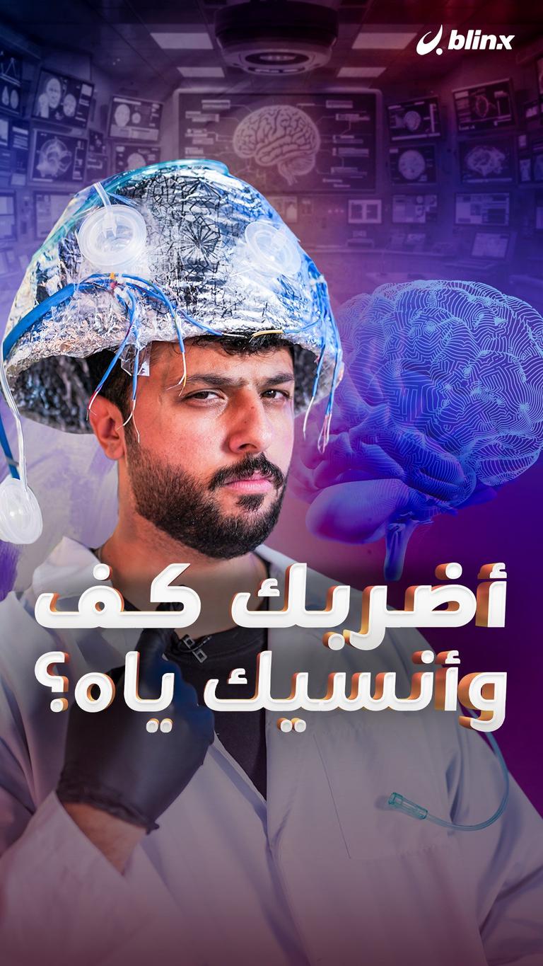 أضربك كف وأنسيك ياه؟